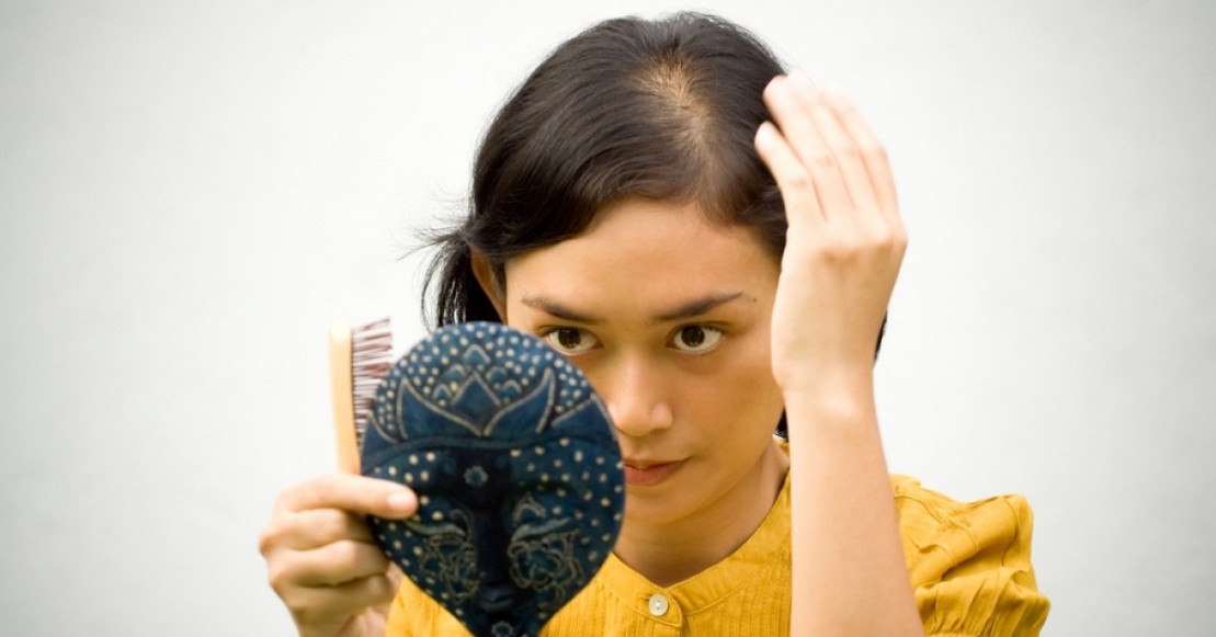 Những bí kíp đơn giản giúp mái tóc chắc khỏe, nhanh chóng thoát khỏi chứng rụng tóc nhiều
